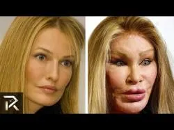 Binary Option Tutorials - Empire Options Video Course Worst Cases Of Plastic Surgery Obse