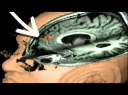 Binary Option Tutorials - Binary Dealer Video Course NOVA scienceNOW : 1 - Mirror Neuron